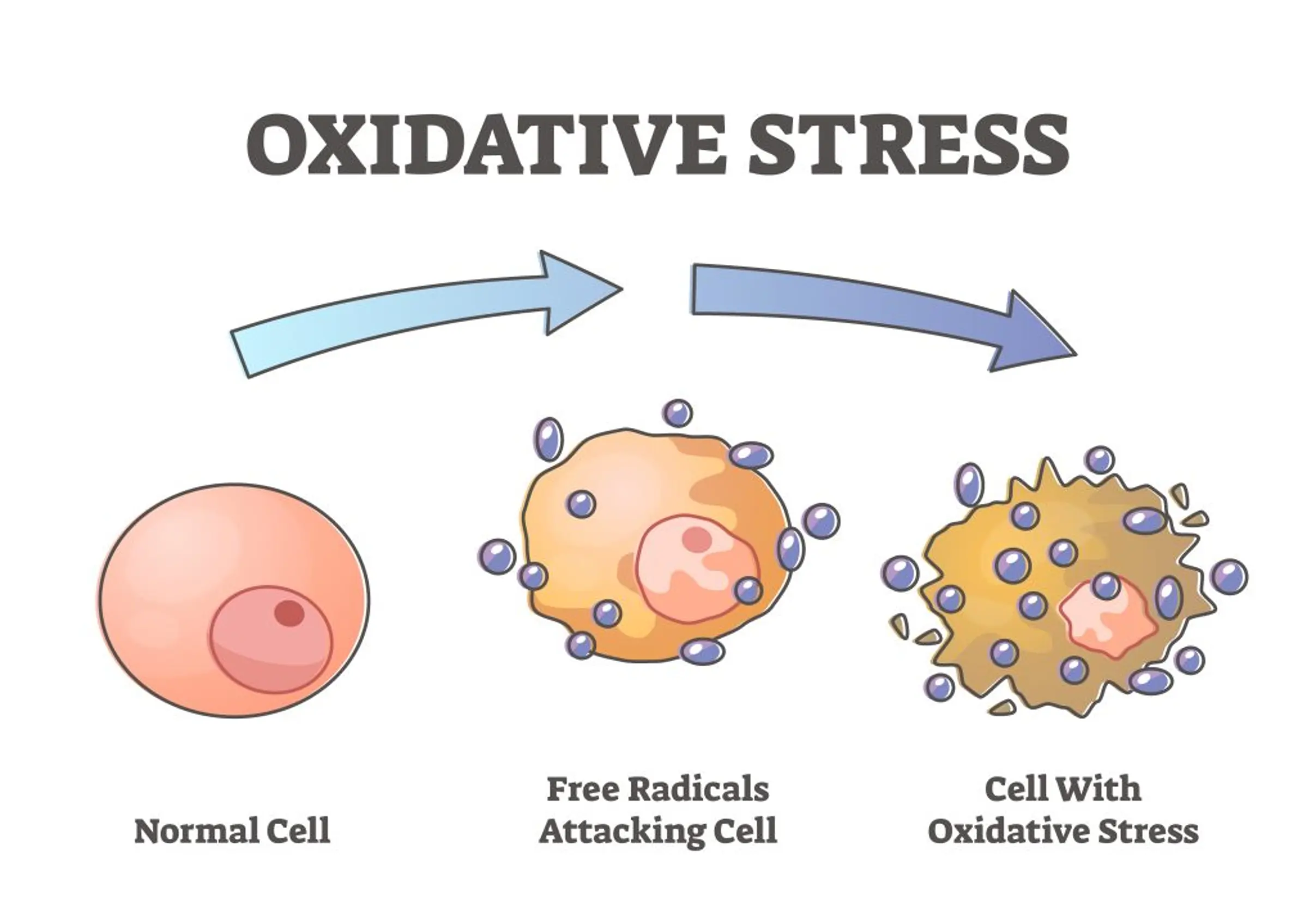 Cellular Representation of an Oxidative Stress