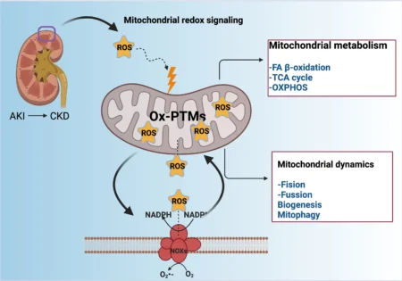 Mitochondrial Redox Signaling and Oxidative Stress in Kidney Diseases